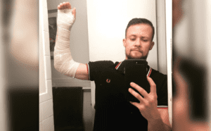 A man taking a selfie with his arm in a cast.